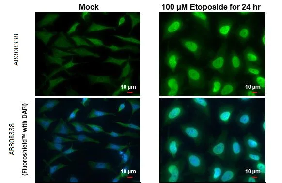 Immunocytochemistry/ Immunofluorescence - Anti-ATM phospho Ser1981 antibody [HL1062] (AB308338)