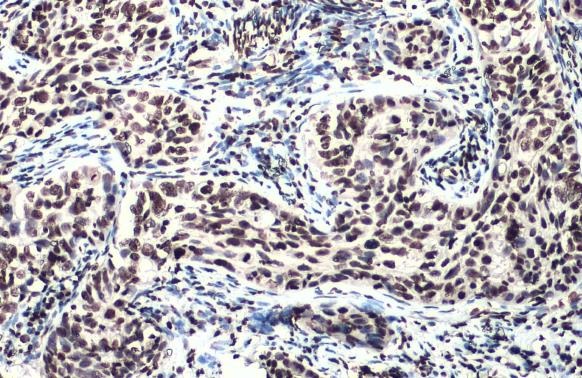 Immunohistochemistry (Formalin/PFA-fixed paraffin-embedded sections) - Anti-ATM phospho Ser1981 antibody [HL1062] (AB308338), expandable thumbnail