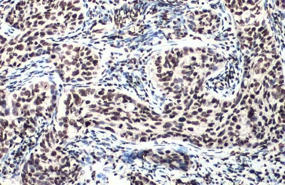 Immunohistochemistry (Formalin/PFA-fixed paraffin-embedded sections) - Anti-ATM phospho Ser1981 antibody [HL1062] (AB308338)