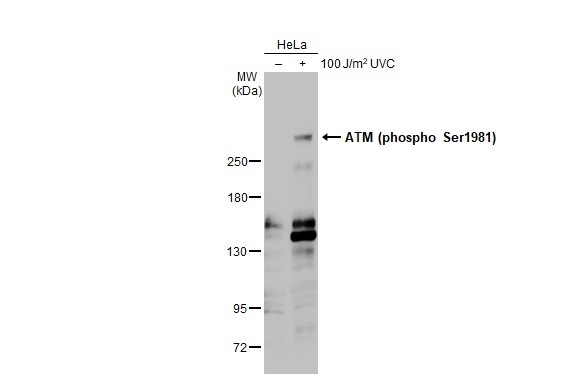 Western blot - Anti-ATM phospho Ser1981 antibody [HL1062] (AB308338), expandable thumbnail