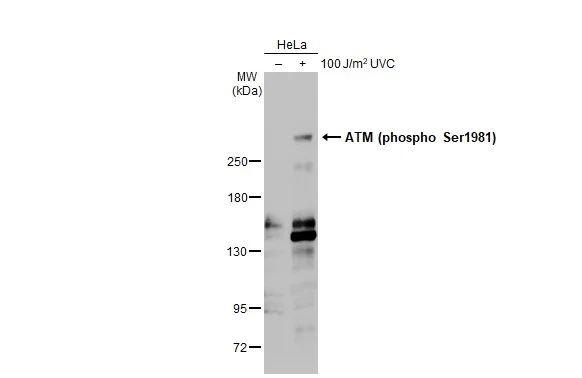 Western blot - Anti-ATM phospho Ser1981 antibody [HL1062] (AB308338)