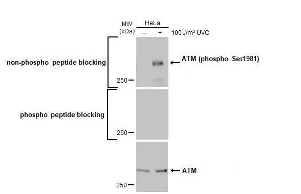 Western blot - Anti-ATM phospho Ser1981 antibody [HL1062] (AB308338), expandable thumbnail