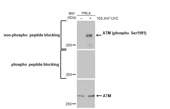 Western blot - Anti-ATM phospho Ser1981 antibody [HL1062] (AB308338)
