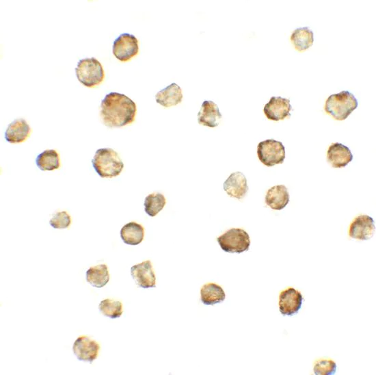 Immunocytochemistry - Anti-ATMIN antibody - N-terminal (AB191856)