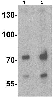 Western blot - Anti-ATMIN antibody - N-terminal (AB191856)