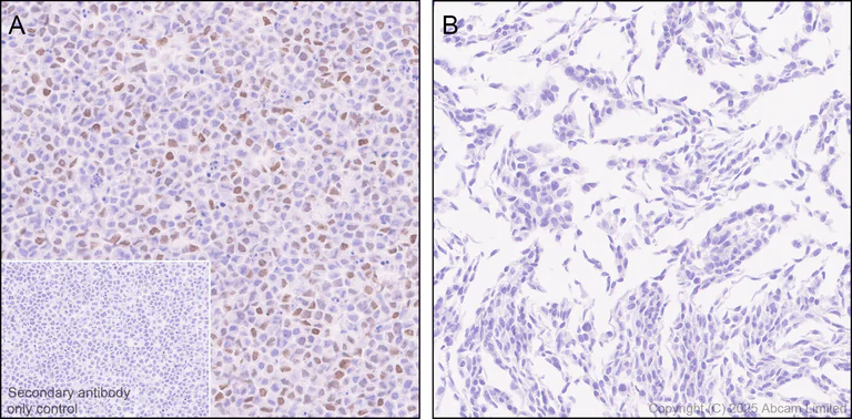 Immunohistochemistry (Formalin/PFA-fixed paraffin-embedded sections) - Anti-Atoh1 (Math1/Hath1) antibody [EPR29650-154] (AB325324)