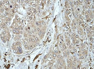 Immunohistochemistry (Formalin/PFA-fixed paraffin-embedded sections) - Anti-ATOX1 antibody (AB176993), expandable thumbnail