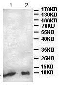 Western blot - Anti-ATOX1 antibody (AB176993), expandable thumbnail