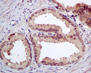 Zkkページ Anti-ATOX1 antibody [EPR10352] (ab154179) | Abcam