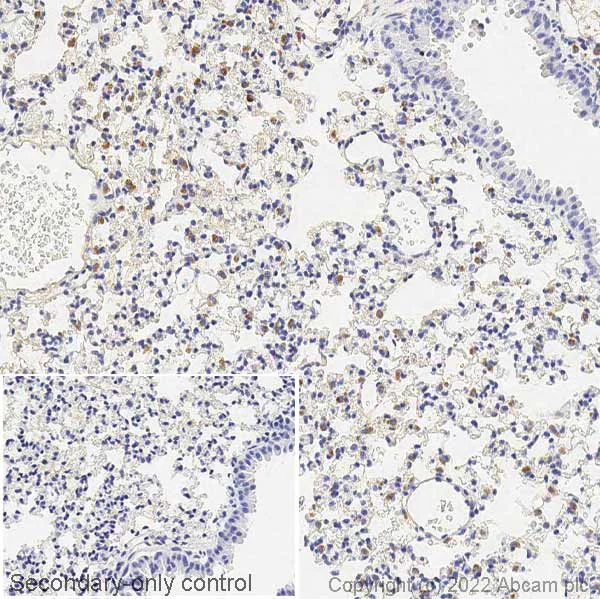 Immunohistochemistry (Formalin/PFA-fixed paraffin-embedded sections) - Anti-ATP-binding cassette sub-family A member 3 antibody [3C9] (AB24751)