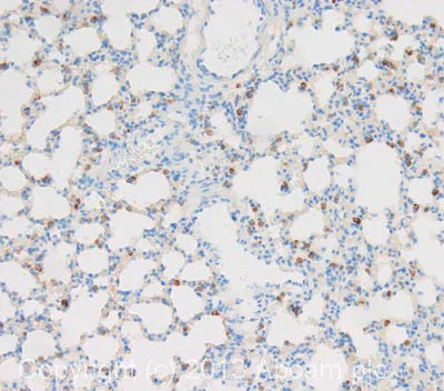 Immunohistochemistry (Formalin/PFA-fixed paraffin-embedded sections) - Anti-ATP-binding cassette sub-family A member 3 antibody [3C9] (AB24751)