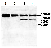 Western blot - Anti-ATP-binding cassette sub-family A member 3 antibody (AB99856), expandable thumbnail