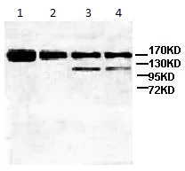 Western blot - Anti-ATP-binding cassette sub-family A member 3 antibody (AB99856)