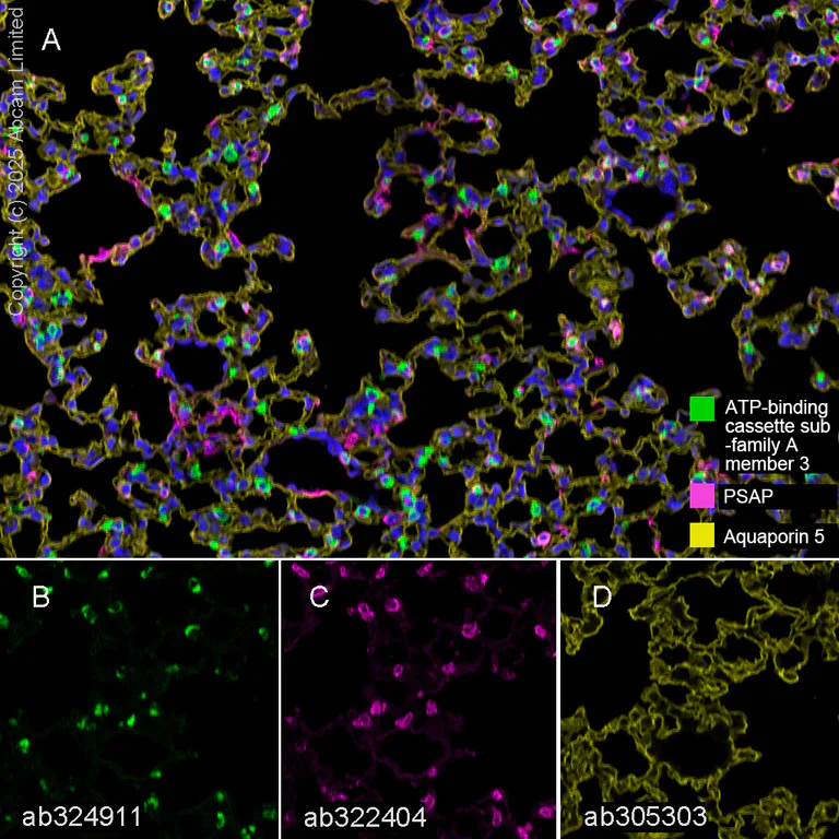 Multiplex immunohistochemistry - Anti-ATP-binding cassette sub-family A member 3 antibody [EPR29622-109] (AB324911)