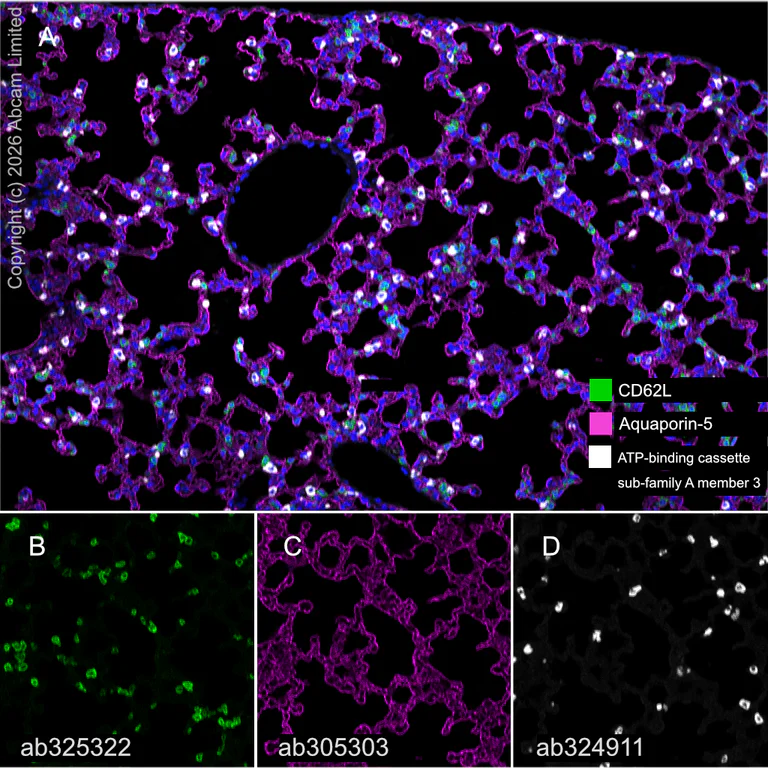 Multiplex immunohistochemistry - Anti-ATP-binding cassette sub-family A member 3 antibody [EPR29622-109] (AB324911)