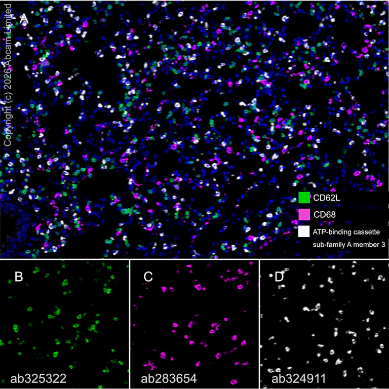 Multiplex immunohistochemistry - Anti-ATP-binding cassette sub-family A member 3 antibody [EPR29622-109] (AB324911)