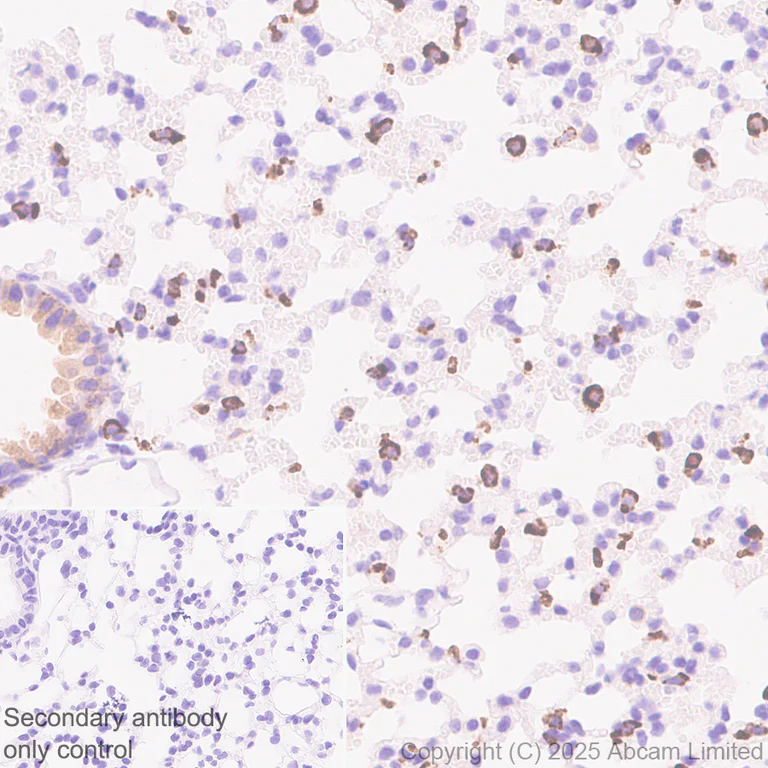 Immunohistochemistry (Formalin/PFA-fixed paraffin-embedded sections) - Anti-ATP-binding cassette sub-family A member 3 antibody [EPR29622-109] - BSA and Azide free (AB324915)