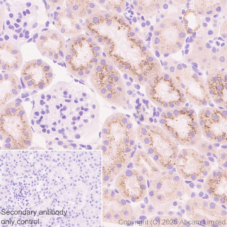 Immunohistochemistry (Formalin/PFA-fixed paraffin-embedded sections) - Anti-ATP-binding cassette sub-family A member 3 antibody [EPR29622-109] - BSA and Azide free (AB324915)