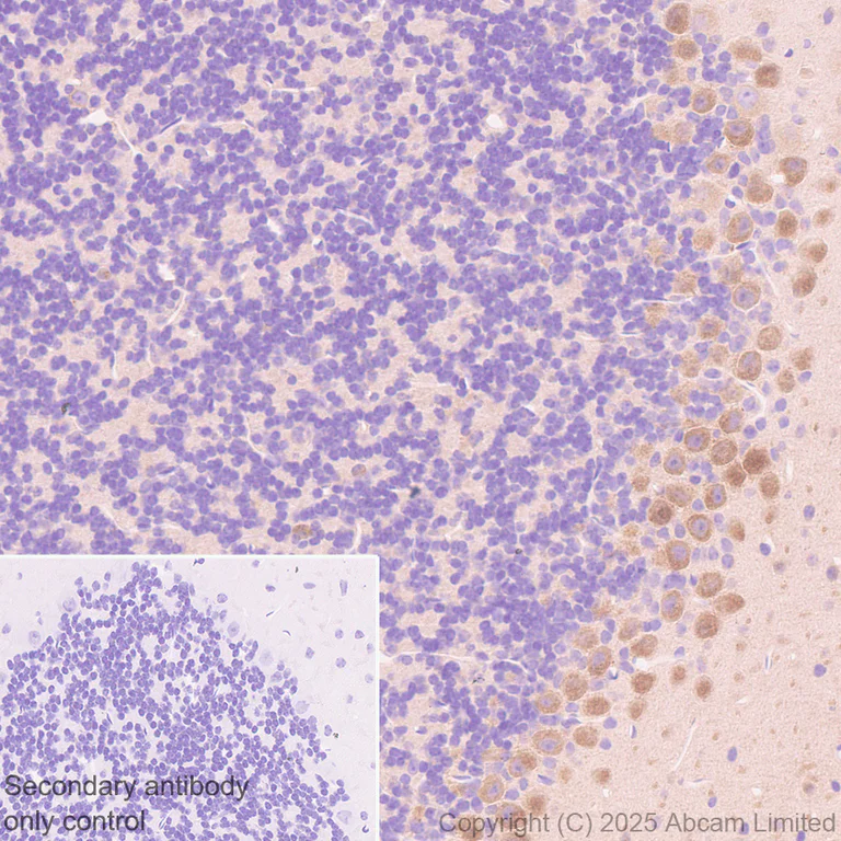 Immunohistochemistry (Formalin/PFA-fixed paraffin-embedded sections) - Anti-ATP-binding cassette sub-family A member 3 antibody [EPR29622-109] - BSA and Azide free (AB324915)