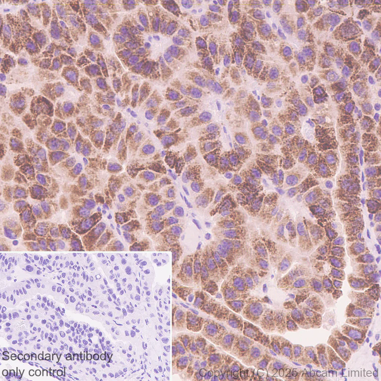 Immunohistochemistry (Formalin/PFA-fixed paraffin-embedded sections) - Anti-ATP-binding cassette sub-family A member 3 antibody [EPR29622-109] - BSA and Azide free (AB324915)