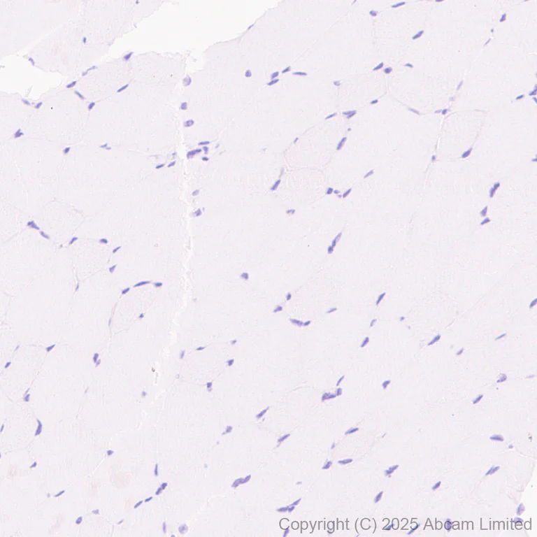 Immunohistochemistry (Formalin/PFA-fixed paraffin-embedded sections) - Anti-ATP-binding cassette sub-family A member 3 antibody [EPR29622-109] - BSA and Azide free (AB324915)