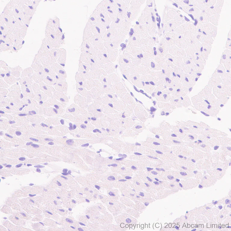 Immunohistochemistry (Formalin/PFA-fixed paraffin-embedded sections) - Anti-ATP-binding cassette sub-family A member 3 antibody [EPR29622-109] - BSA and Azide free (AB324915)