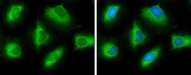 Immunocytochemistry/ Immunofluorescence - Anti-ATP citrate lyase antibody (AB126129)
