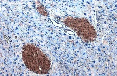 Immunohistochemistry (Formalin/PFA-fixed paraffin-embedded sections) - Anti-ATP citrate lyase antibody (AB126129)