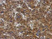 Immunohistochemistry (Formalin/PFA-fixed paraffin-embedded sections) - Anti-ATP citrate lyase antibody (AB126129)