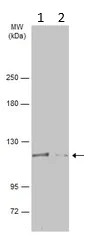 Western blot - Anti-ATP citrate lyase antibody (AB126129)