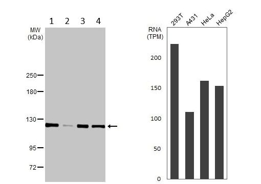 Western blot - Anti-ATP citrate lyase antibody (AB126129)