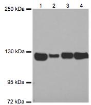 Western blot - Anti-ATP citrate lyase antibody (AB126129), expandable thumbnail