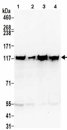 Western blot - Anti-ATP citrate lyase antibody (AB157098), expandable thumbnail