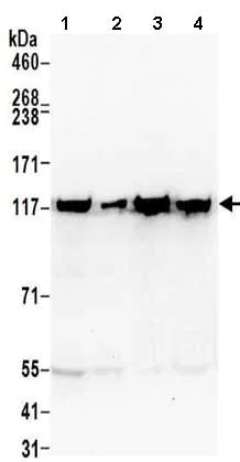 Western blot - Anti-ATP citrate lyase antibody (AB157098)