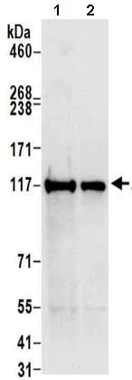 Western blot - Anti-ATP citrate lyase antibody (AB157098)