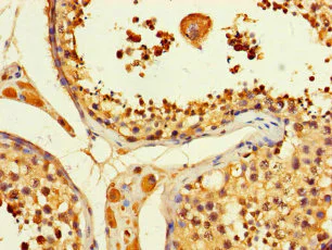 Immunohistochemistry (Formalin/PFA-fixed paraffin-embedded sections) - Anti-ATP citrate lyase antibody (AB235926)