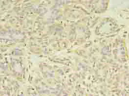 Immunohistochemistry (Formalin/PFA-fixed paraffin-embedded sections) - Anti-ATP citrate lyase antibody (AB235926)