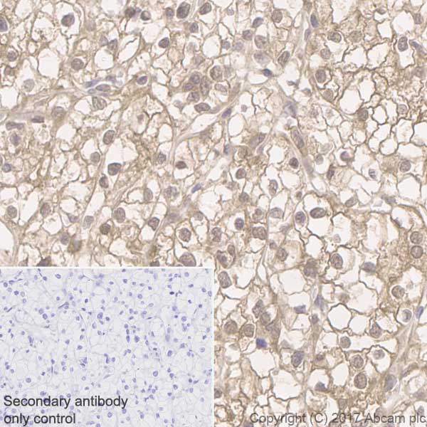 Immunohistochemistry (Formalin/PFA-fixed paraffin-embedded sections) - Anti-ATP citrate lyase antibody [EP704Y] (ab40793), expandable thumbnail