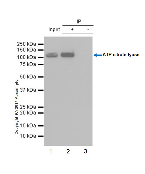 Immunoprecipitation - Anti-ATP citrate lyase antibody [EP704Y] (AB40793), expandable thumbnail