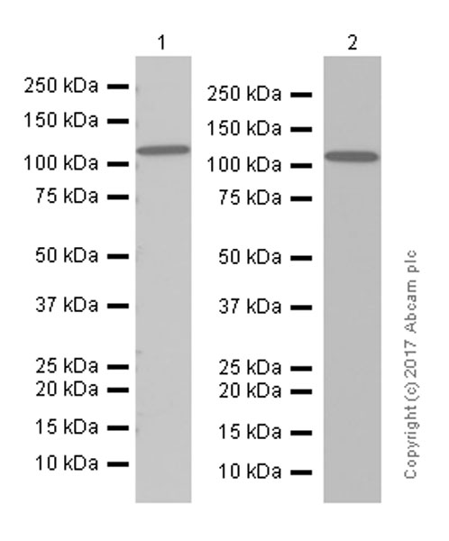 Western blot - Anti-ATP citrate lyase antibody [EP704Y] (ab40793), expandable thumbnail
