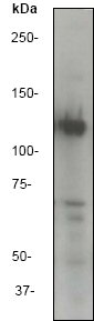 Western blot - Anti-ATP citrate lyase antibody [EP704Y] (ab40793), expandable thumbnail
