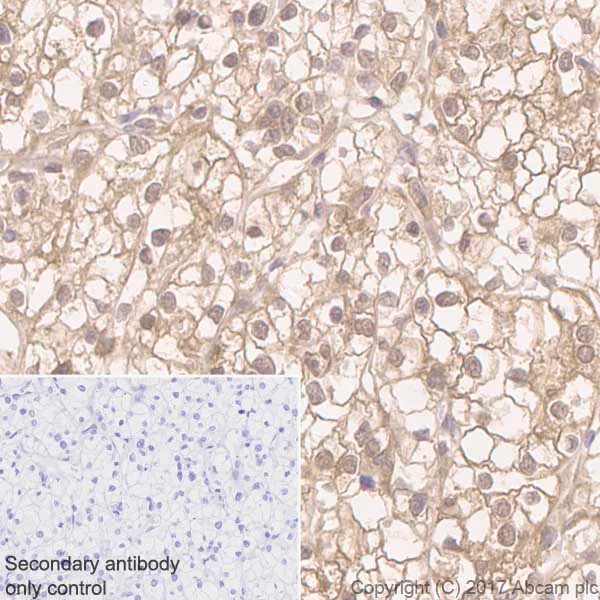 Immunohistochemistry (Formalin/PFA-fixed paraffin-embedded sections) - Anti-ATP citrate lyase antibody [EP704Y] - BSA and Azide free (AB227996)