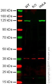 Western blot - Anti-ATP citrate lyase antibody [EP704Y] - BSA and Azide free (AB227996)