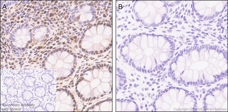 Immunohistochemistry (Formalin/PFA-fixed paraffin-embedded sections) - Anti-ATP citrate lyase (phospho S455) antibody [EPR31107-40] (AB327419)