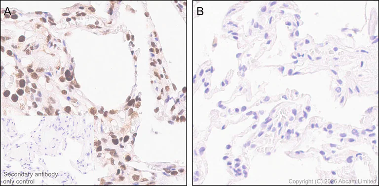 Immunohistochemistry (Formalin/PFA-fixed paraffin-embedded sections) - Anti-ATP citrate lyase (phospho S455) antibody [EPR31107-40] (AB327419)