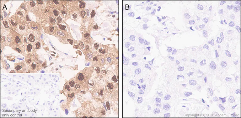 Immunohistochemistry (Formalin/PFA-fixed paraffin-embedded sections) - Anti-ATP citrate lyase (phospho S455) antibody [EPR31107-40] (AB327419)