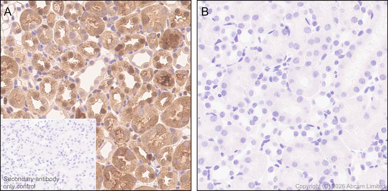 Immunohistochemistry (Formalin/PFA-fixed paraffin-embedded sections) - Anti-ATP citrate lyase (phospho S455) antibody [EPR31107-40] (AB327419)