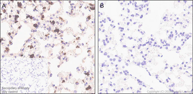 Immunohistochemistry (Formalin/PFA-fixed paraffin-embedded sections) - Anti-ATP citrate lyase (phospho S455) antibody [EPR31107-40] (AB327419)