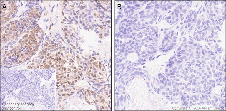 Immunohistochemistry (Formalin/PFA-fixed paraffin-embedded sections) - Anti-ATP citrate lyase (phospho S455) antibody [EPR31107-40] (AB327419)