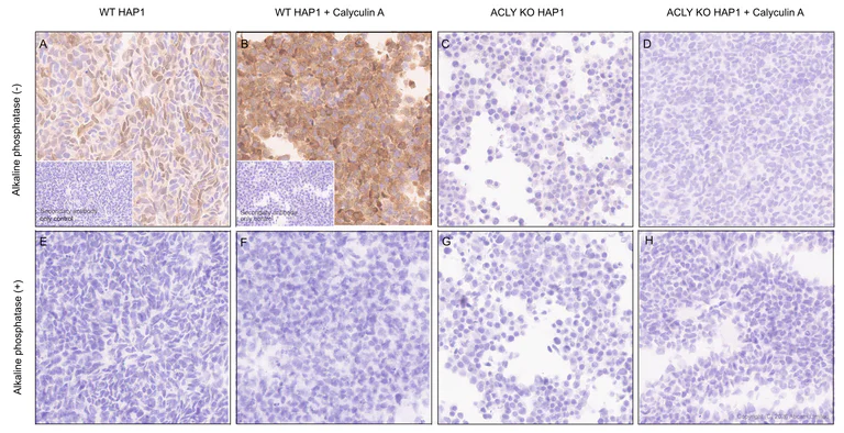 Immunohistochemistry (Formalin/PFA-fixed paraffin-embedded sections) - Anti-ATP citrate lyase (phospho S455) antibody [EPR31107-40] (AB327419)